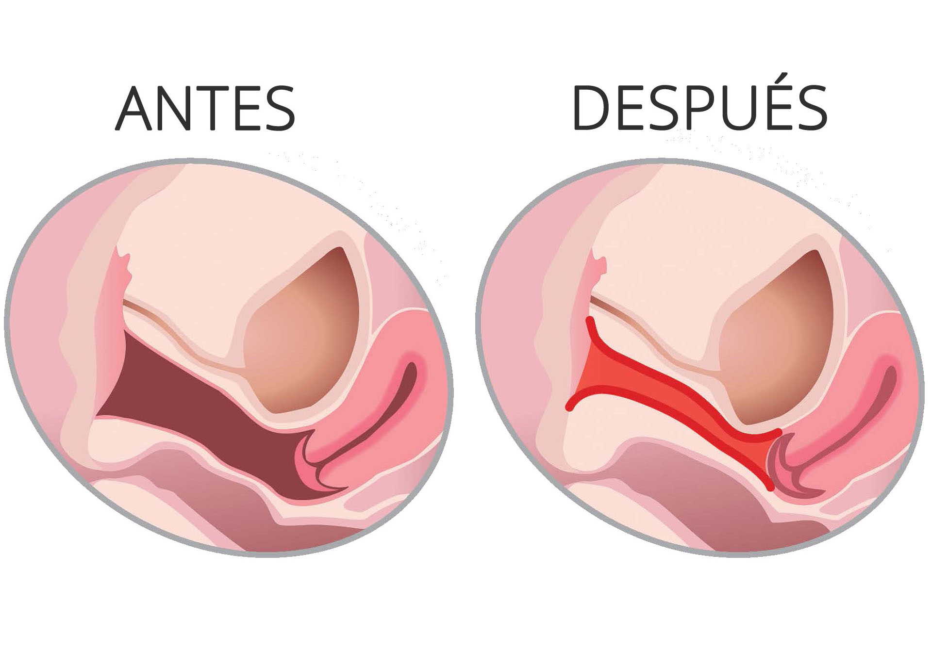 abcde