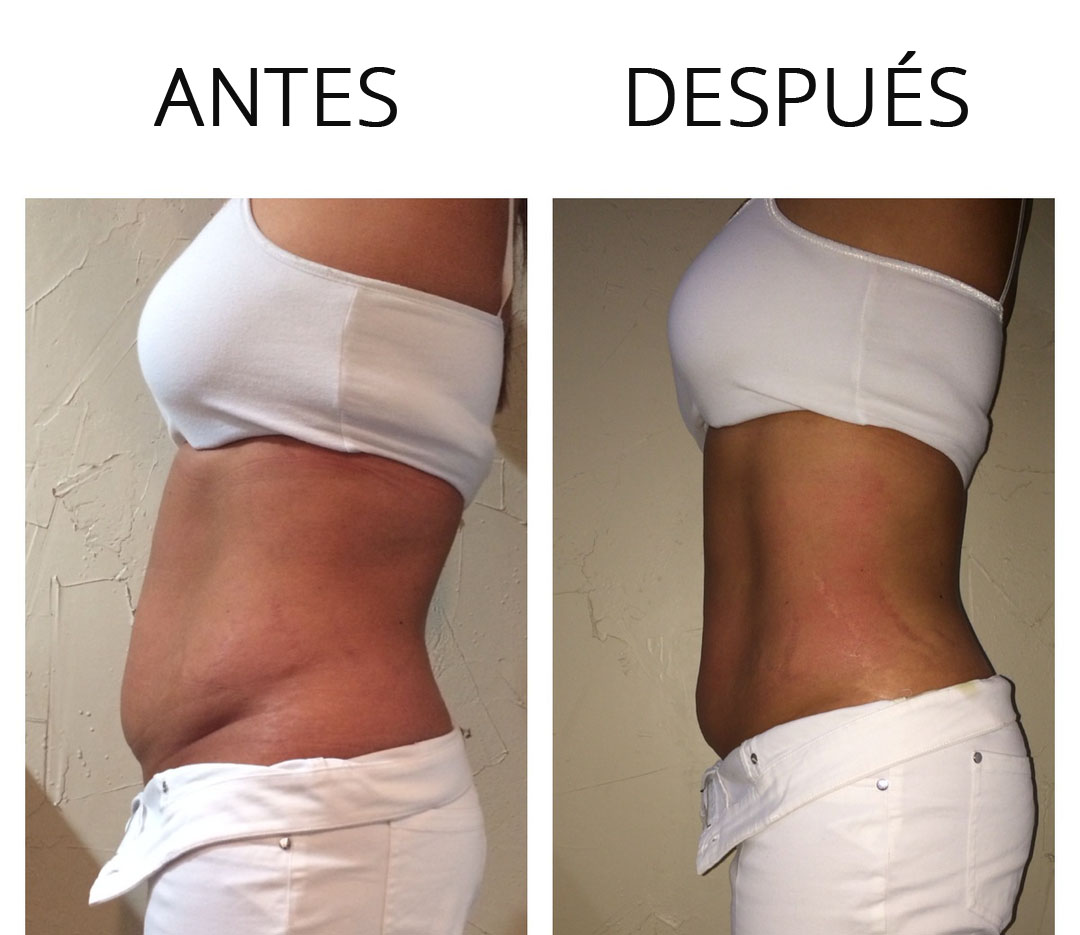 abcde