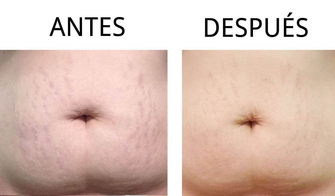 abcde